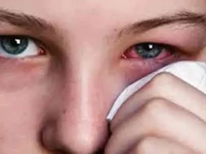 eye