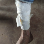 બન્ની વિસ્તાર માં જંગલી ભૂંડ નો આતંક